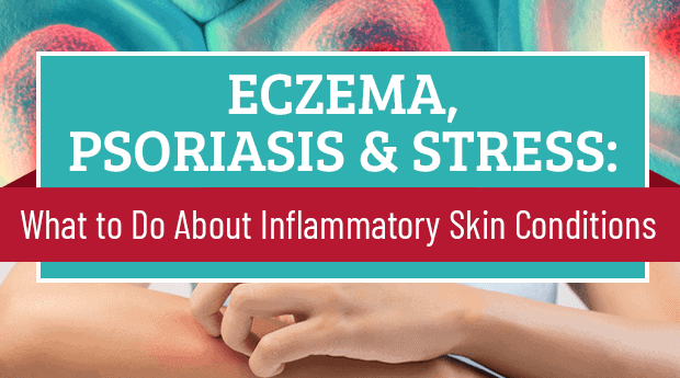 Eczema, Psoriasis & Stress: What to Do About Inflammatory Skin Conditions